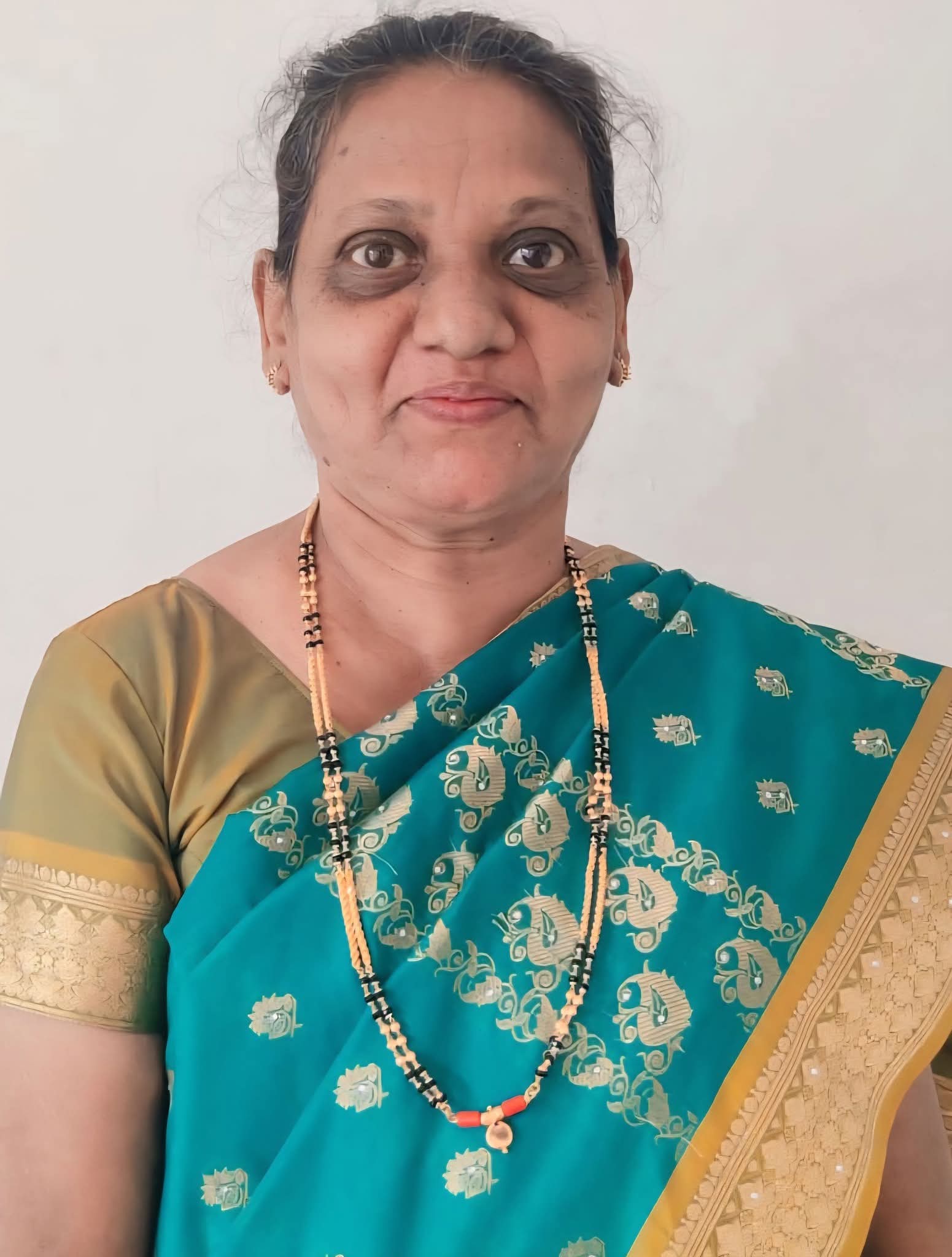 Obituary -Daina Almedia (62) Barkur