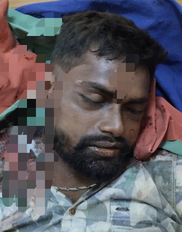 ಉಪ್ಪೂರು ಬಳಿ ಹಿಟ್ ಆ್ಯಂಡ್ ರನ್: ಅಪರಿಚಿತ ವ್ಯಕ್ತಿ ಸಾವು